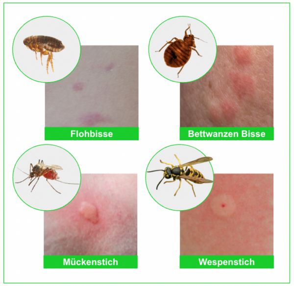 Flohbisse erkennen und behandeln Wie sie aussehen und was wirklich